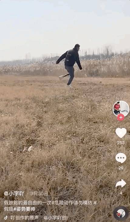 梁开宇_义肢_生活