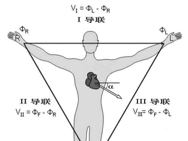 你知道心电图四肢导联位置是哪里吗