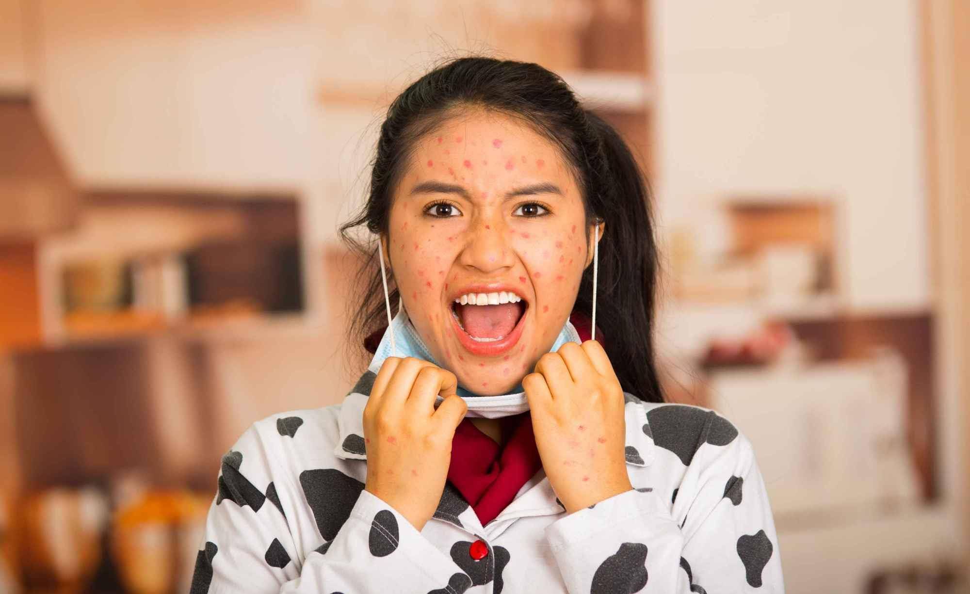 原创脸蛋过敏毁所有脸上过敏发红发痒怎么办呢这几个方法可缓解