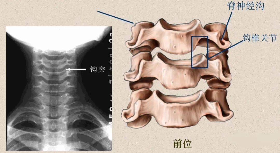 分叉)關節面側塊,較大橫突——橫突孔,椎動脈,神經根溝齒狀突——寰椎