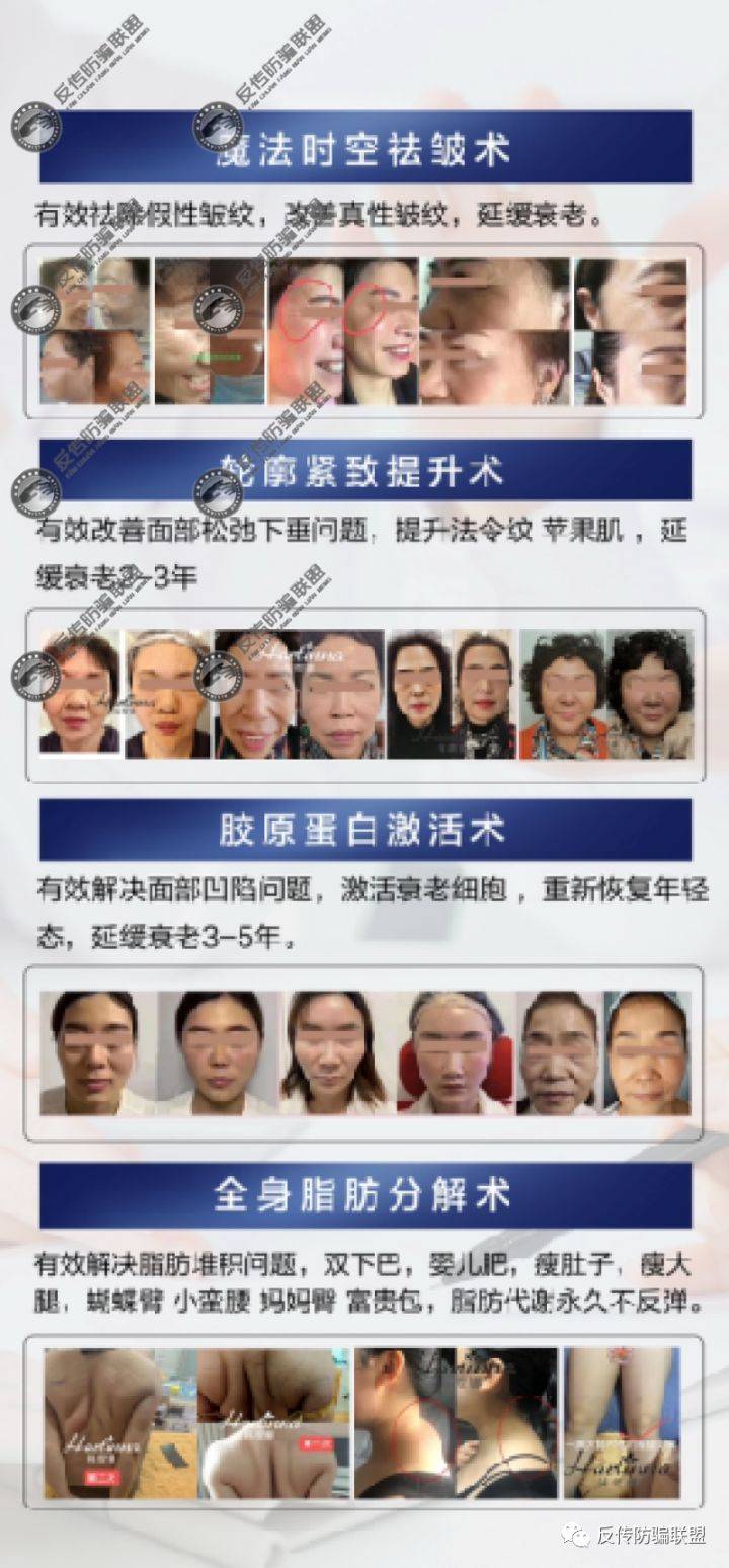 不打针不手术 黑科技瘦身抗衰的“韩缇娜”有点“黑”(图3)