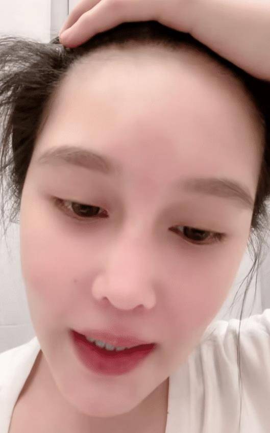 原创赵本山女儿回应恋情问题素颜秀植发效果和大7岁男友频传分手