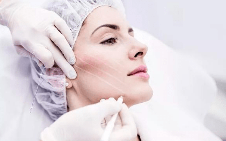 做线雕的危害99%的人不知道?