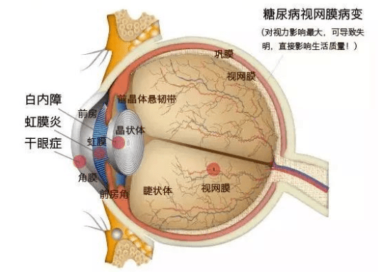 盤點這10類眼病患者所看到的世界原來是這樣