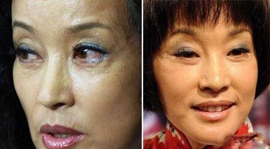 原创久未公开露面的金巧巧终于公开亮相了可是她的脸让人大吃一惊