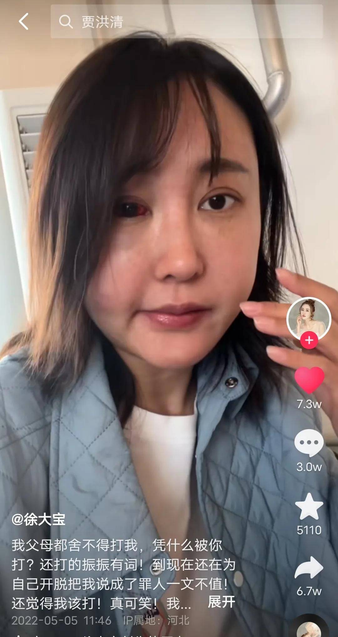 34岁女演员被家暴,拖进房间打到眼肿充血,绝望发声只为离婚_对方_父母
