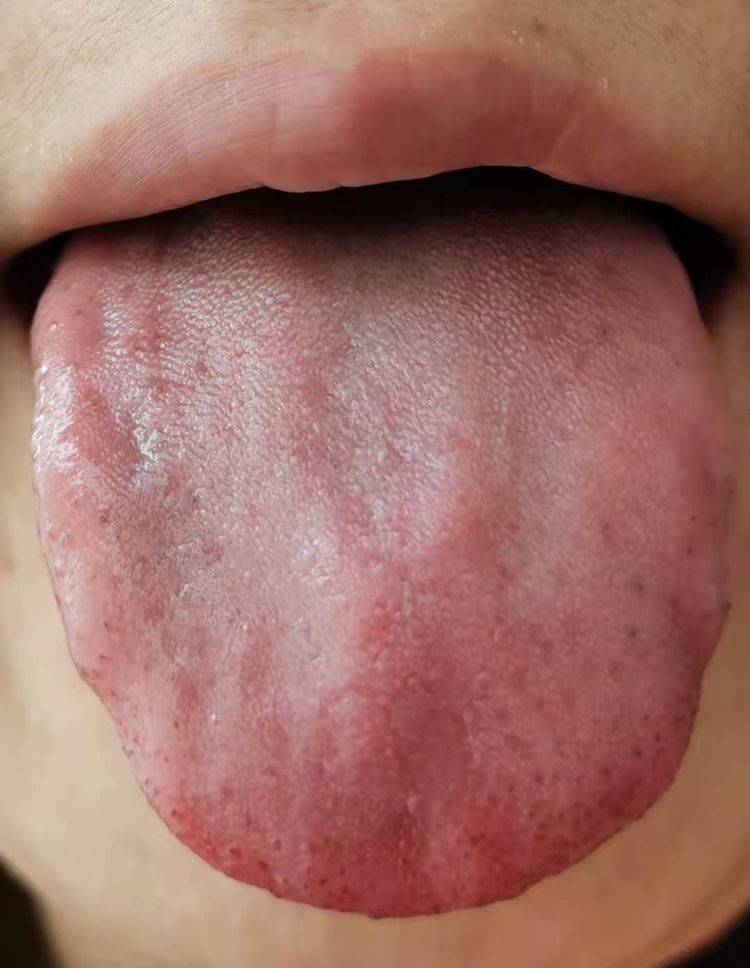 养颜补血调经方,漂亮脸蛋吃出来_女性_舌苔_边尖