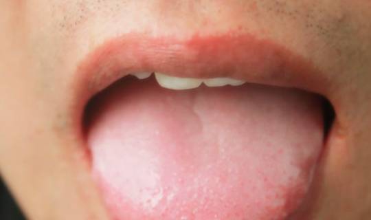 【健康】舌头发出一种信号，快测量血糖