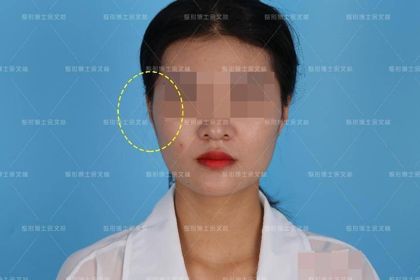 【贴发耳】看了这么多艺人证件照,好像没有耳朵贴面的明星?