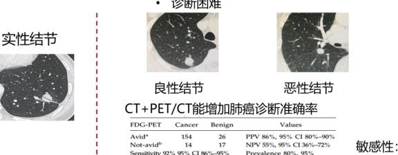 你查出来的肺结节需要治吗？