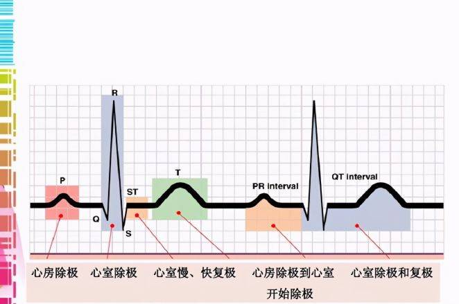 窦性心律是指在人体右心房部位有个由特殊细胞构成的小结叫窦房结