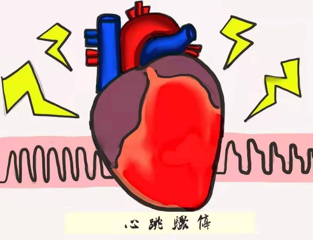心脏骤停是怎么回事