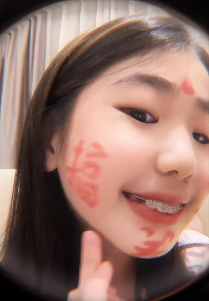 呲,不整齐美观,若不进行矫正的话,未来很可能长成龅牙甚至出现凸嘴