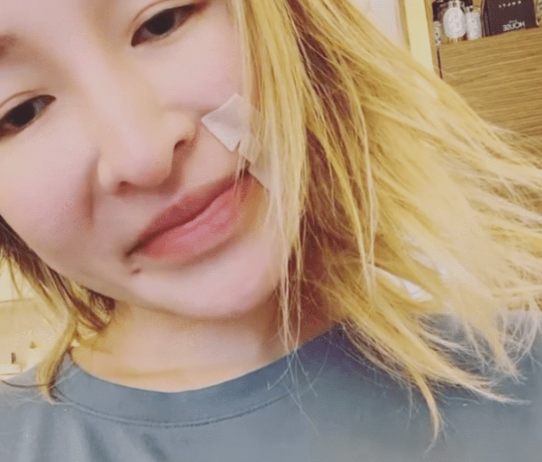 25位明星割过双眼皮谁自然谁毁容一目了然