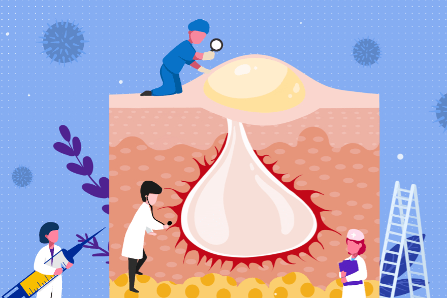 科学护发理性护肤皮肤科举行525全国护肤日系列科普义诊