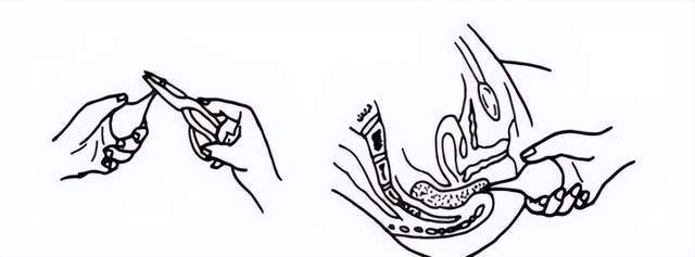 5个方法助你有效解决便秘_药物_药瓶_直肠