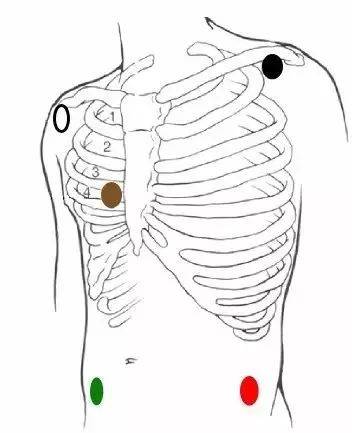 两种规格导联中颜色相同的导线安放的电极片位置并不相同,应用英文