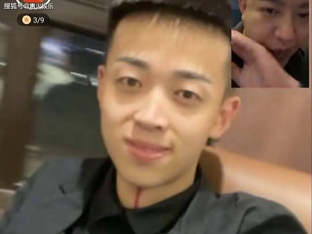 洋洋洋徒弟仙鹏暴打"宇将军"的真实原因曝光,网友:真的太狂了