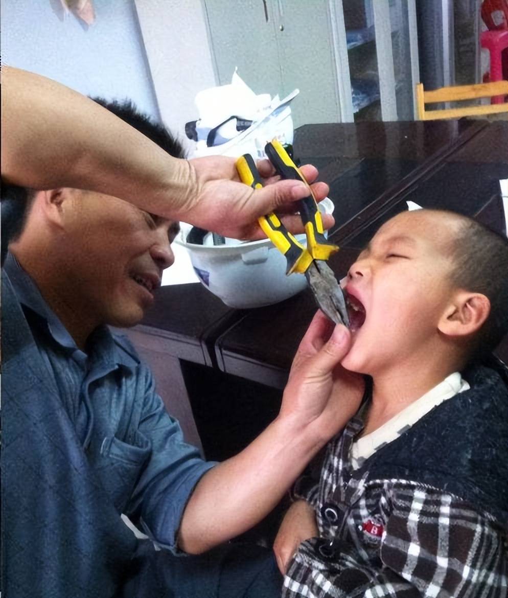 最硬核的拔牙工具:妈妈用"老虎钳"给娃拔牙,隔着屏幕都觉得疼