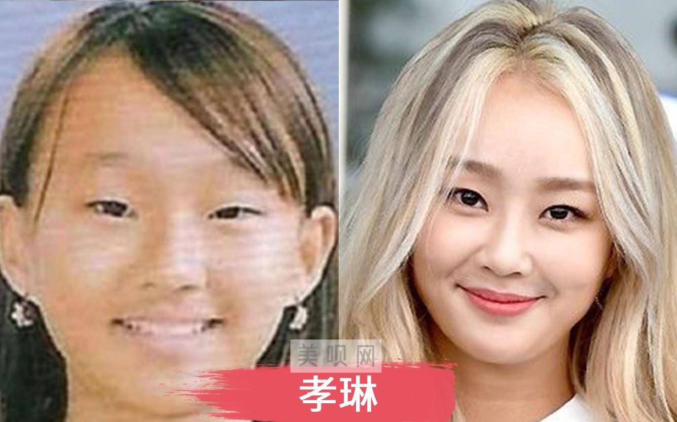原创“我整形了，变得更美了”十位大方承认自己整形的明星盘点