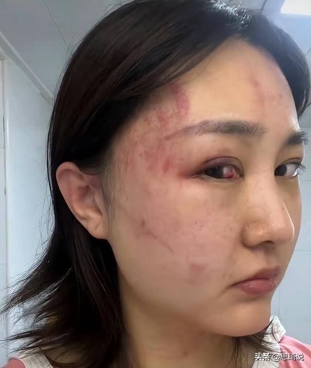 视频中的她被打得鼻青脸肿,眼睛里也布满了血丝.