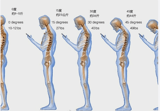 原创长期低头对颈椎伤害有多大