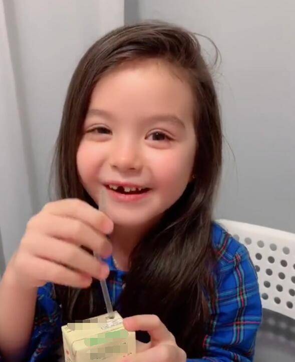 奶瓶牙一旦形成,不光是让牙齿表面变得粗糙难看,还会让牙齿空洞,成为