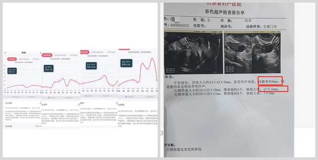 子宫内膜增厚b超图片图片