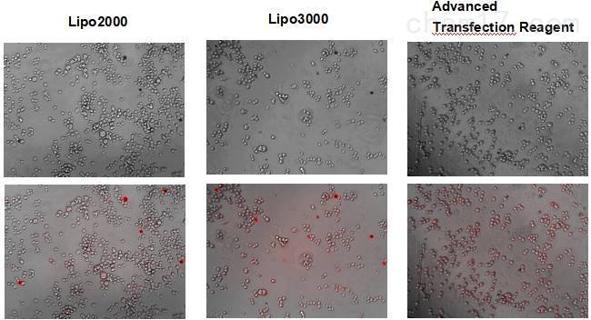 zeta高效转染试剂人淋巴悬浮细胞转染试剂产品说明