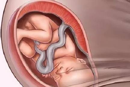 6张图揭示产妇“顺产”全过程，看完好心疼女人！生而为人不容易