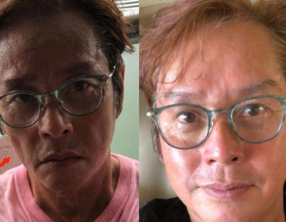 70岁谭咏麟近照曝光,运动过度导致脱水,脸颊瘦到认不出!