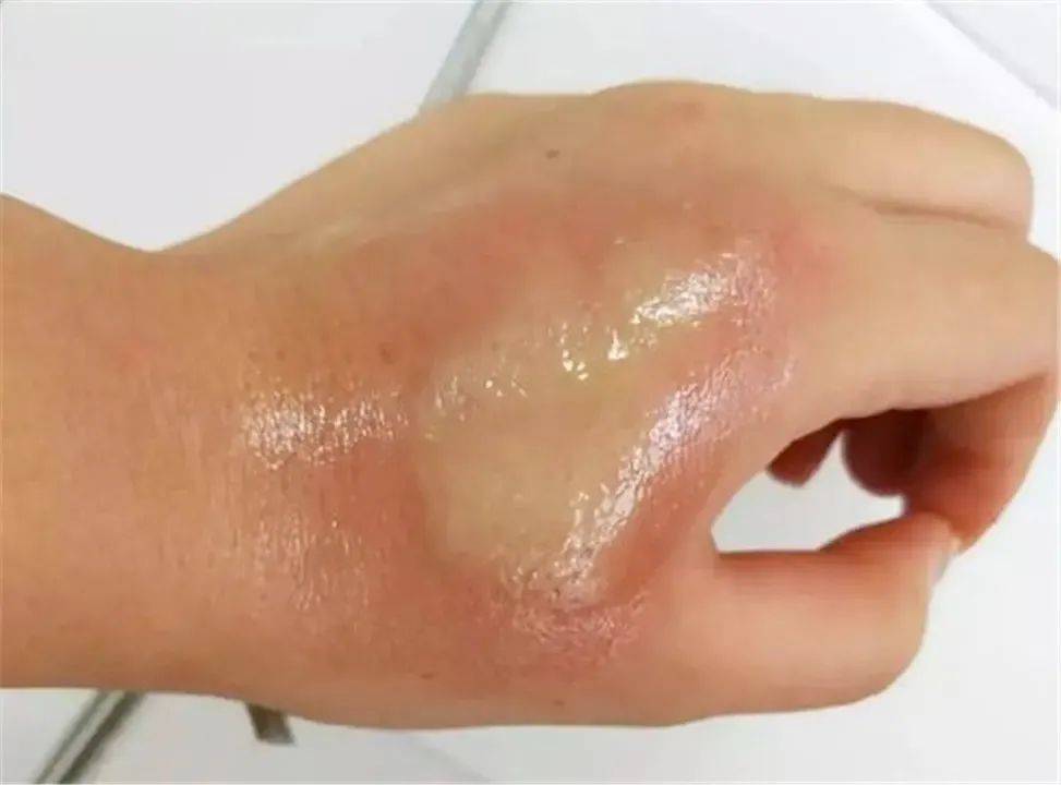 它是农村一大恶虫,被咬一口痛不欲生,如今却成稀罕美食百元一斤_辣子