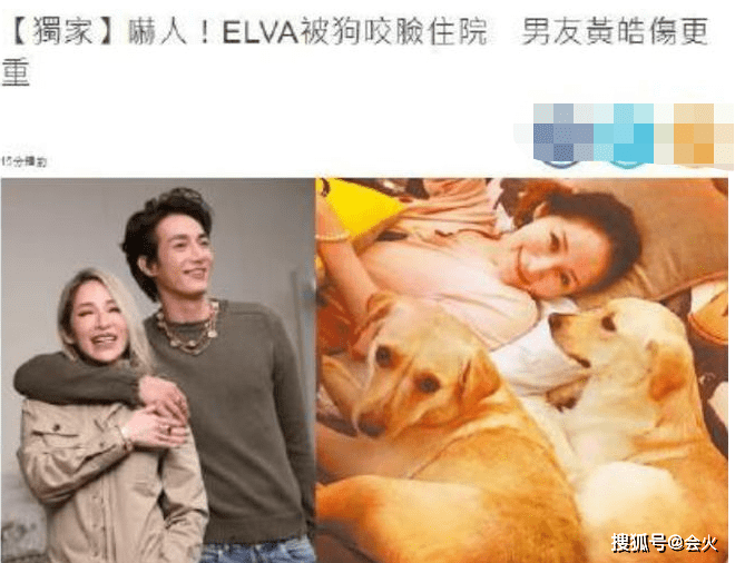 萧亚轩被狗咬后素颜晒疤!下巴布满增生伤痕