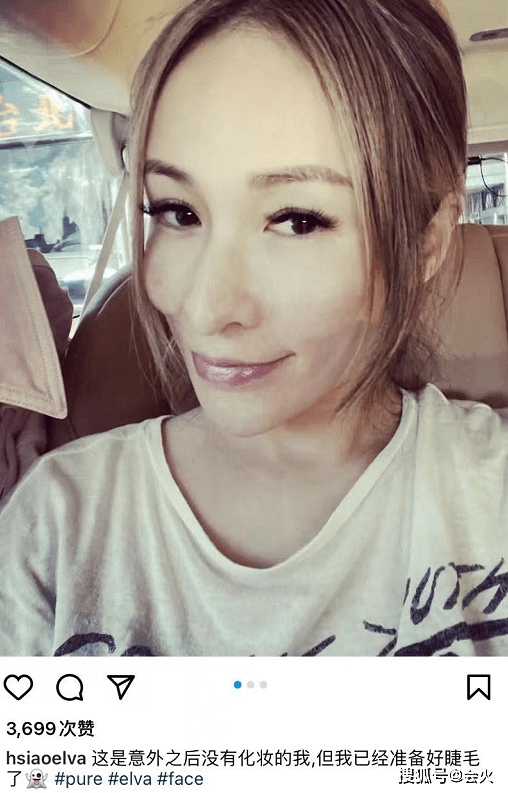 萧亚轩被狗咬后素颜晒疤!下巴布满增生伤痕