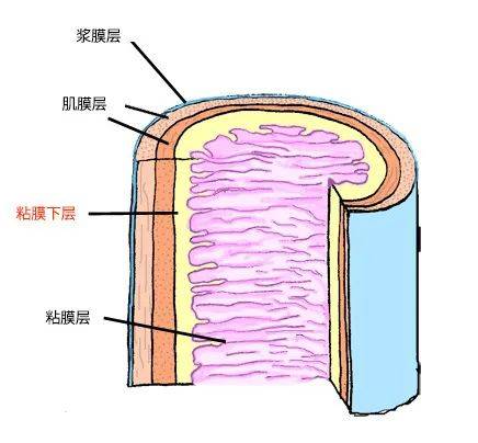 浆膜层图片