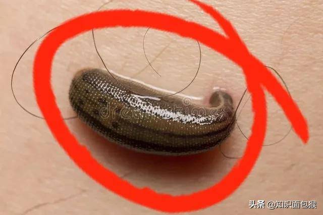 水蛭_皮肤_血液