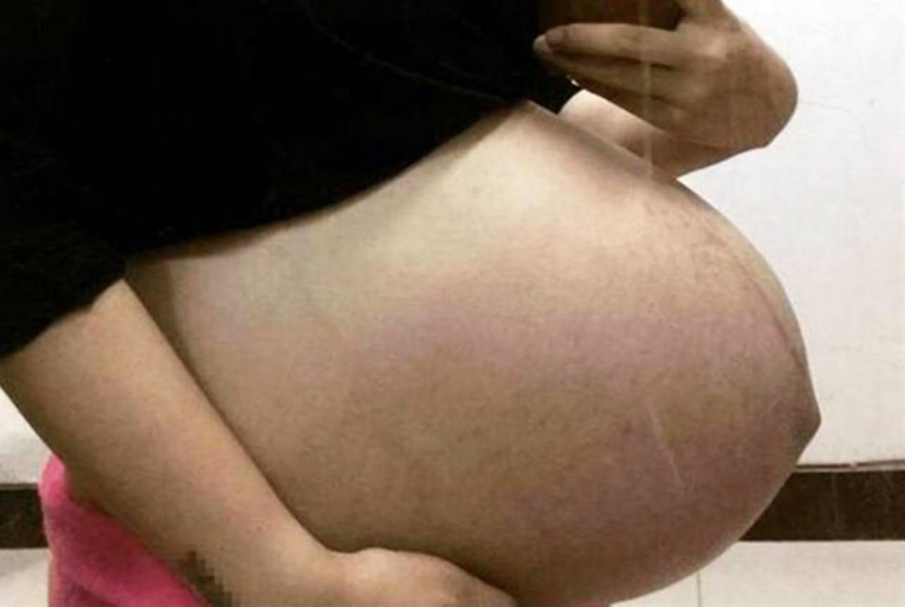 孕晚期肚子有发硬迹象,是孩子快出生的信号吗？准妈妈不能错过