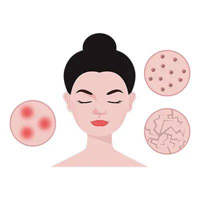 医美科普如何通过医美方式改善毛孔粗大