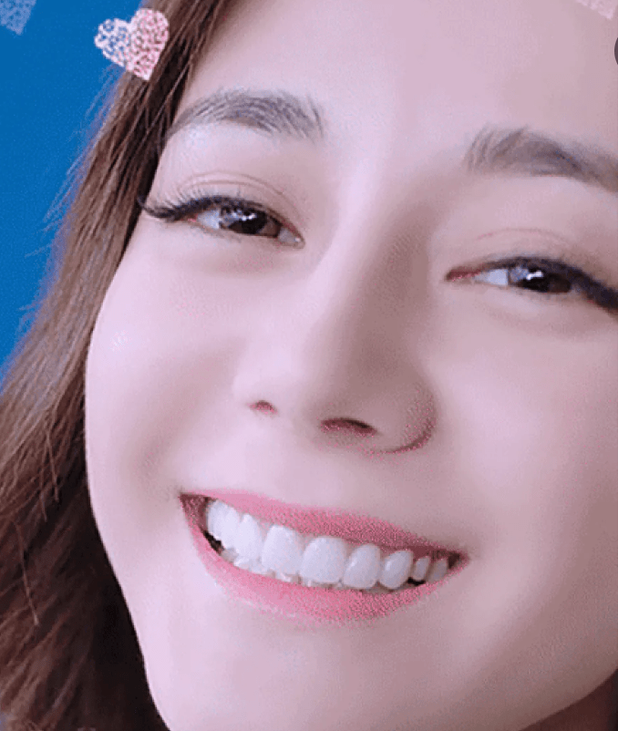 杨紫酒窝消失,刘涛牙龈发灰,这6位女星被整牙“毁”了