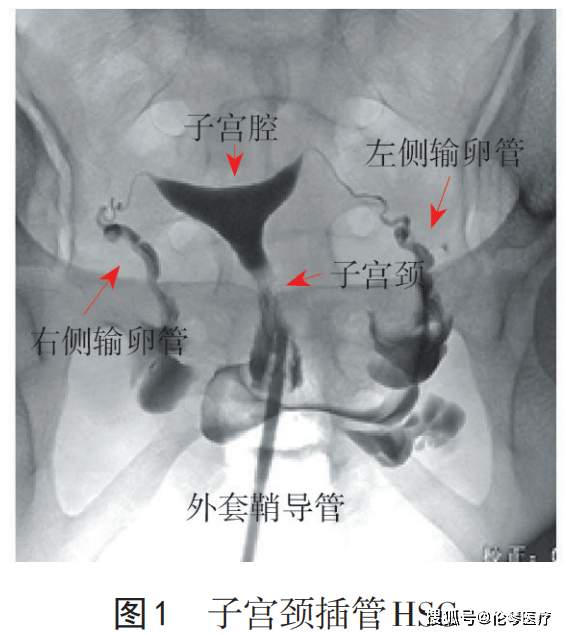 b超图片正常图片子宫图片