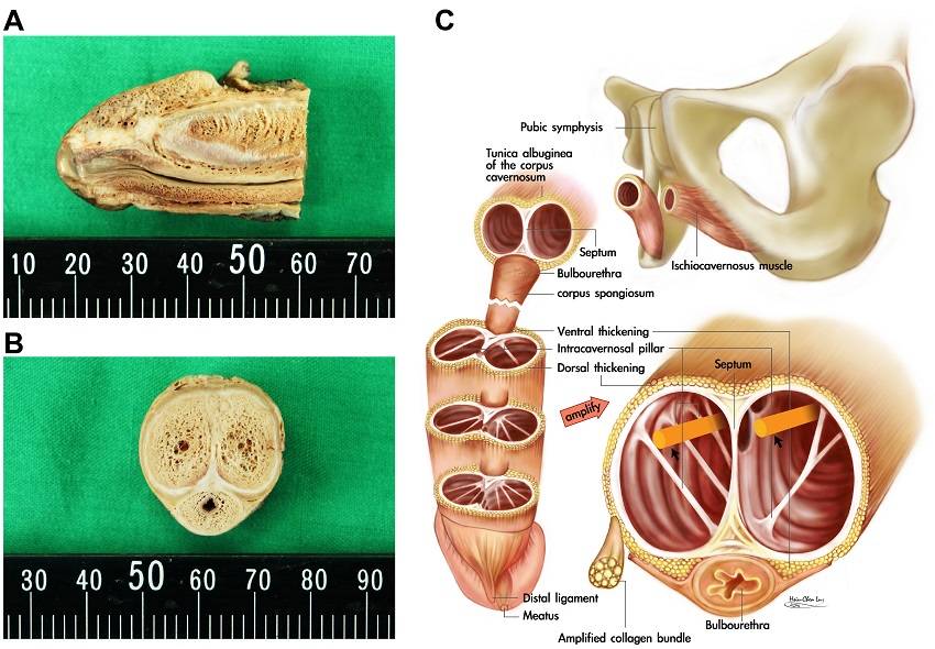 原创医生提醒七夕可以过但是要小心安全比如别把丁丁弄断了