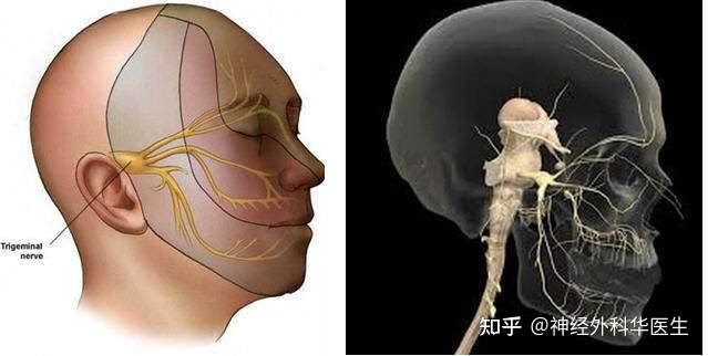 三叉神经痛的早期症状有哪些神经外科副主任姬馨彤告诉你