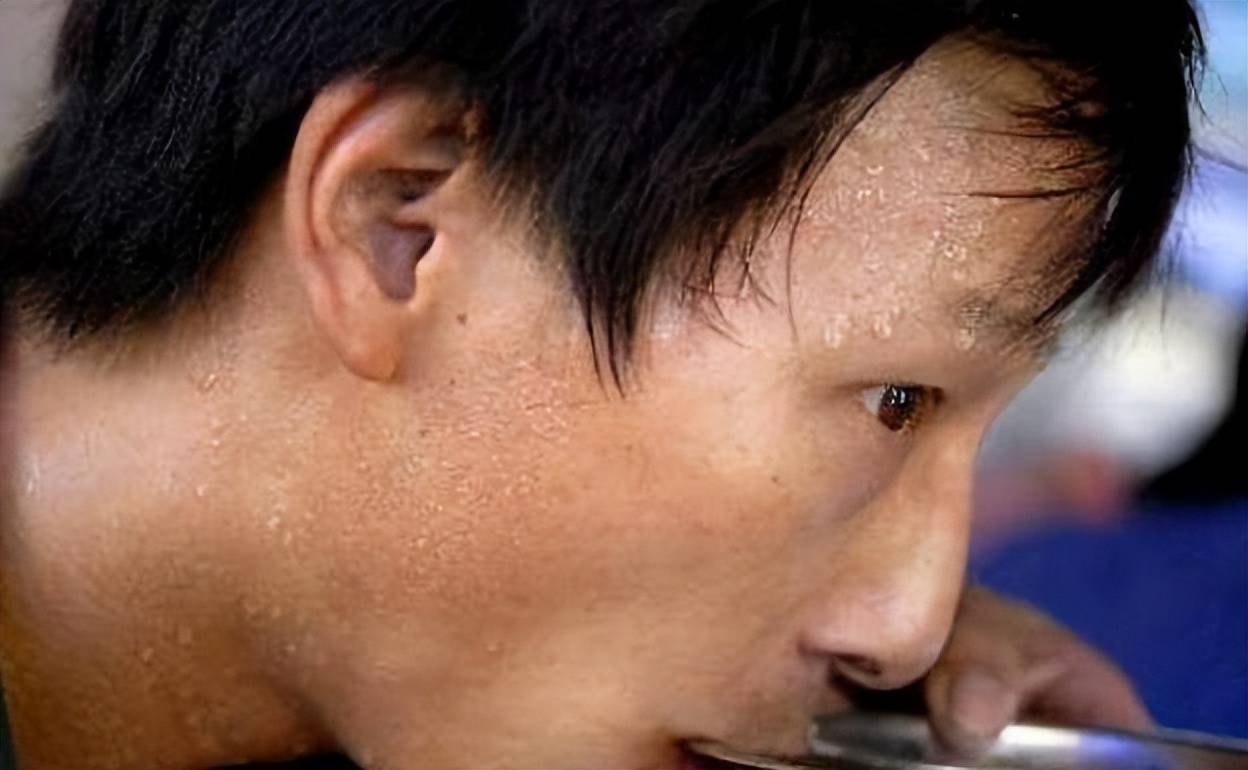 不管什么时候,一吃饭就满头大汗,这是正常现象吗?