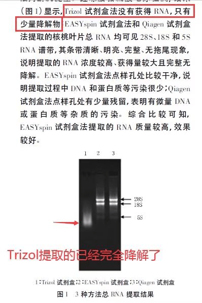 rna电泳图中的三条条带图片