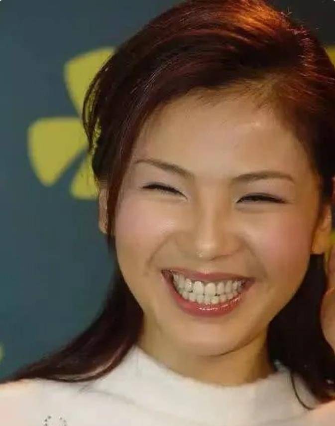 刘涛牙齿脱落,吴宣仪嘴巴合不上,明星们的大白牙真的好看吗?