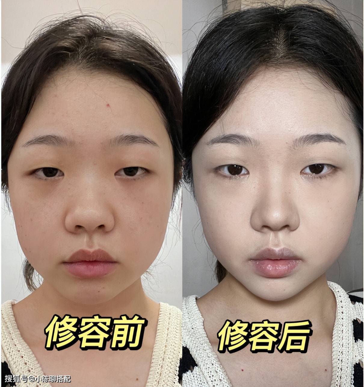 原创
            真正“抗老”的长相，脸部都有这4个特征，看这些反差对比就知道3