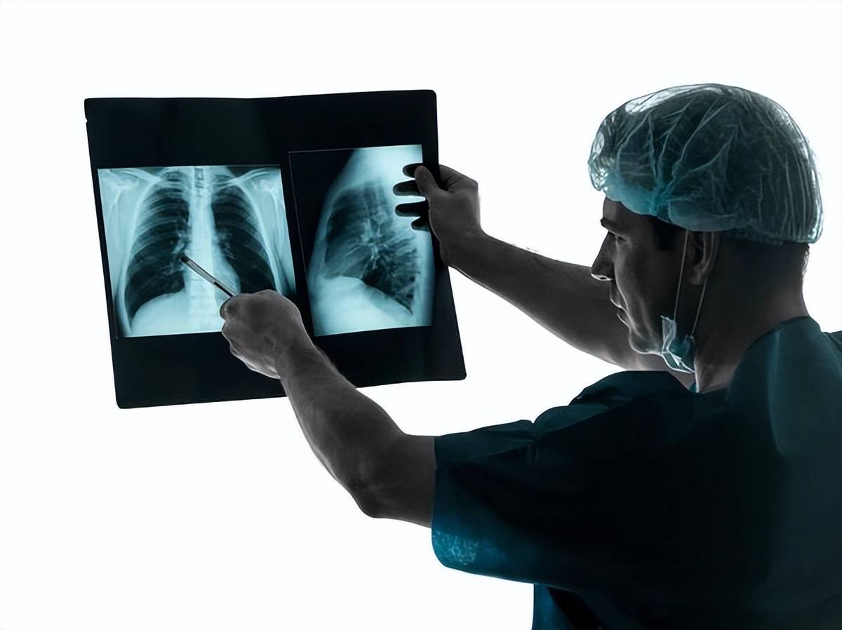 什么样情况下需要警惕＂白肺＂？对于这4种病,有必要及时照个CT