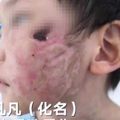 黑龙江4岁女孩被继母虐打进ICU，更多细节曝光，细思极恐