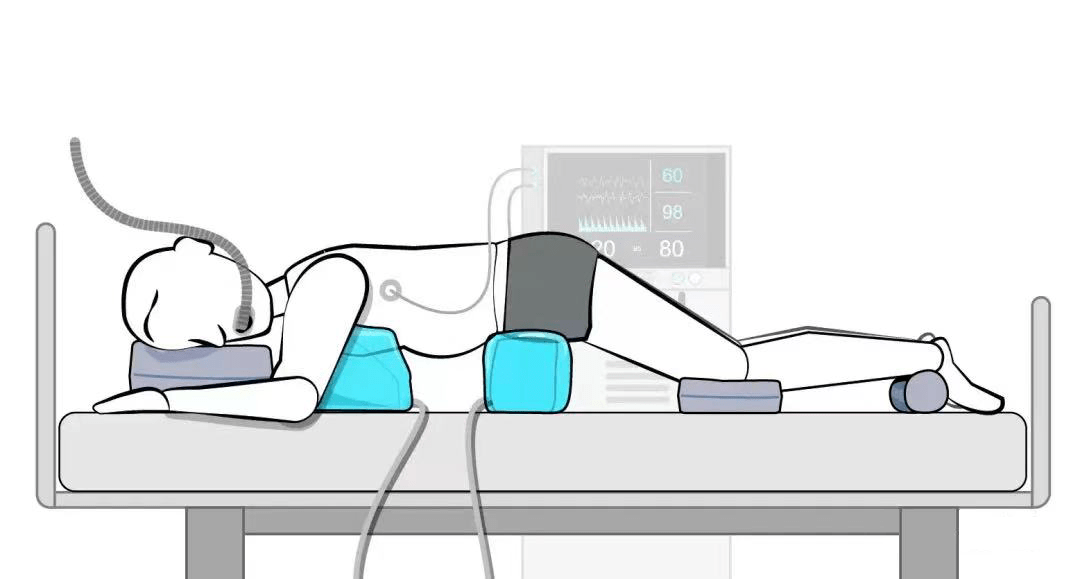 2023年不能躺平,新冠治疗"俯卧位通气"_患者_进行_枕头