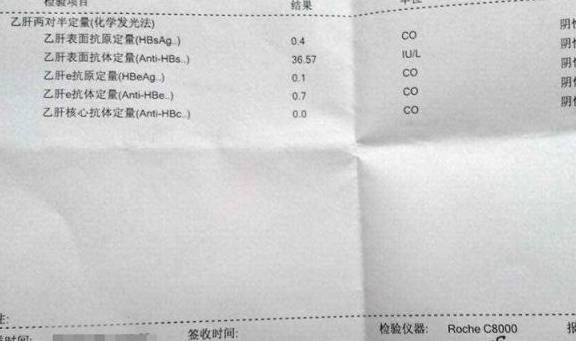 李佳的两对半定量结果提示为2,4,5阳性,高精准hbv-dna定量检查小于20